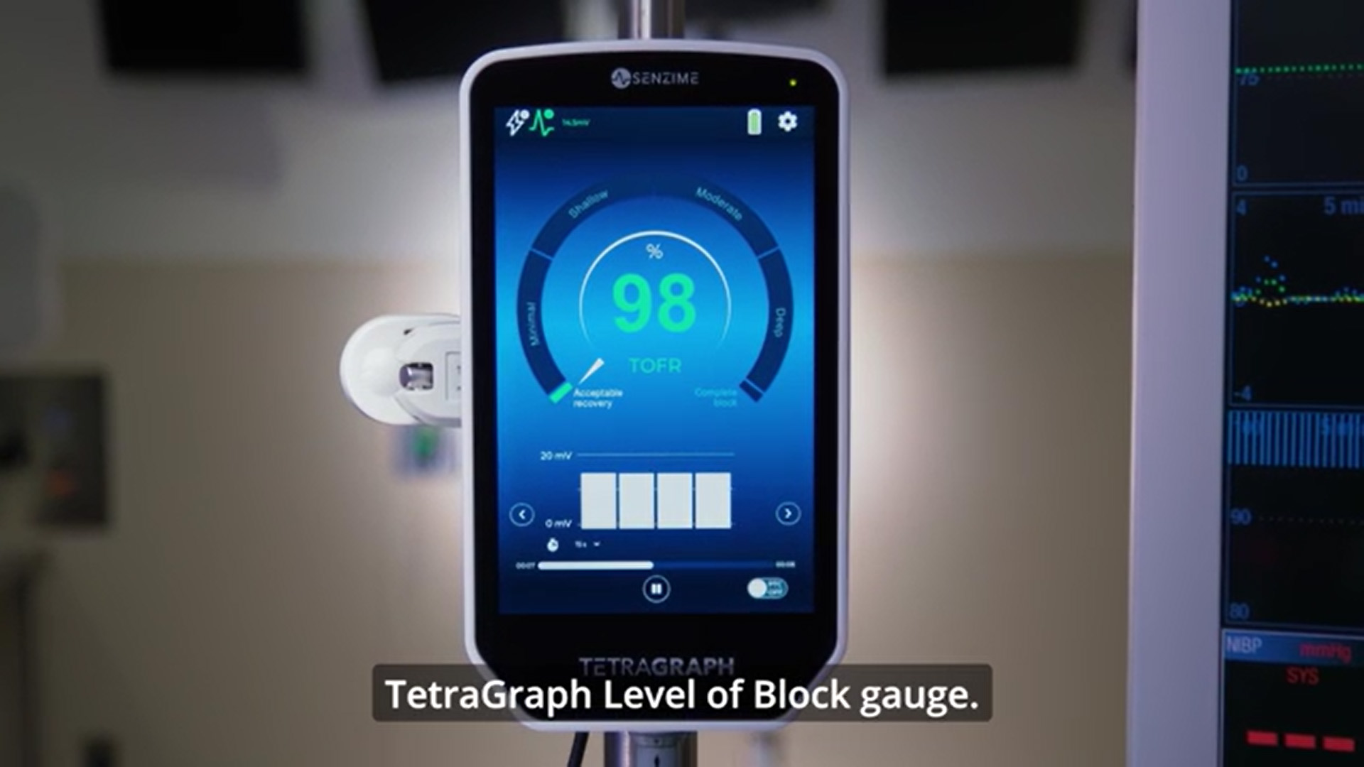 Experience seamless monitoring with TetraGraph’s intelligent design and unmatched precision